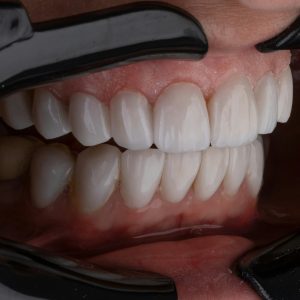 curso de odontología digital