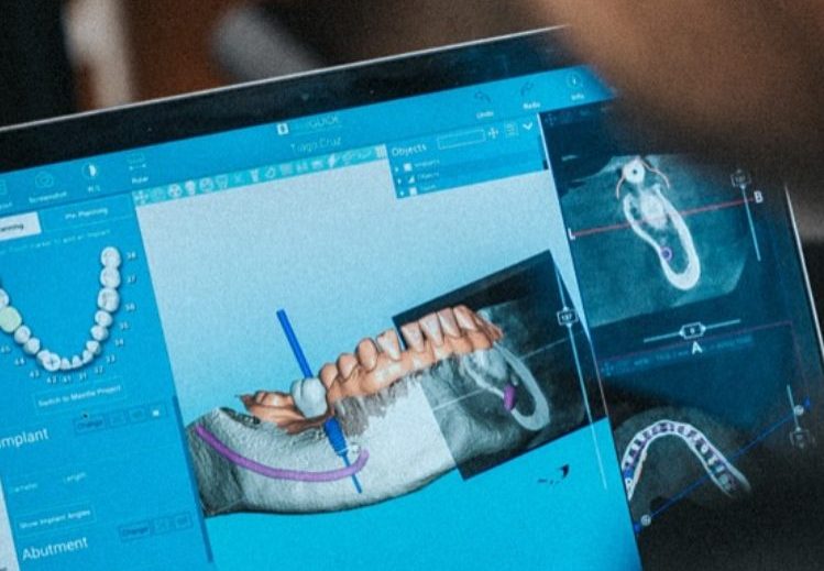 docentes expertos en flujo digital en odontología